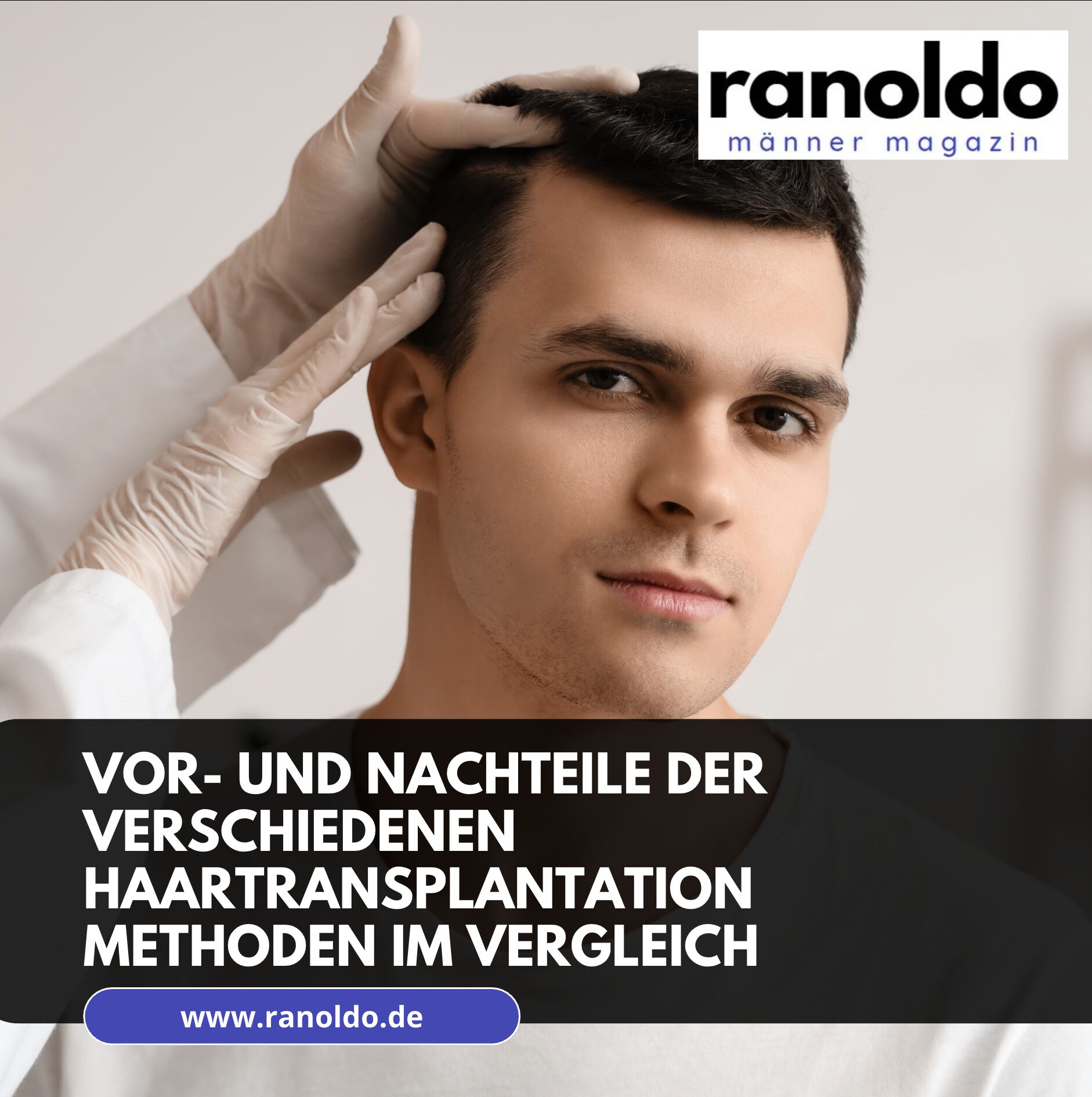 Vor- und Nachteile der verschiedenen Haartransplantation Methoden im Vergleich Vor- und Nachteile der verschiedenen Haartransplantation Methoden im Vergleich